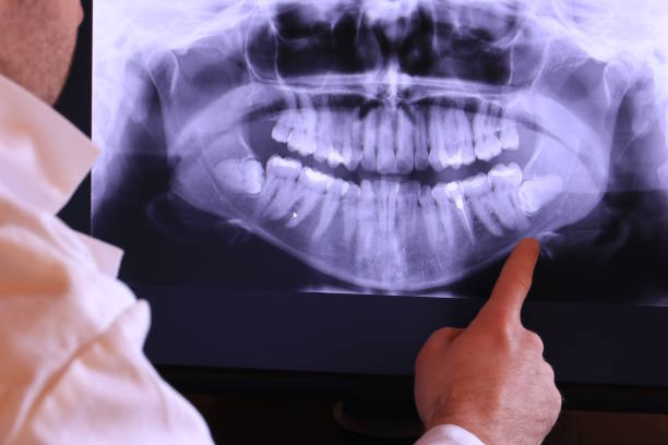 Best Emergency Treatment for Jaw Pain or Injury in Lewisburg, OH